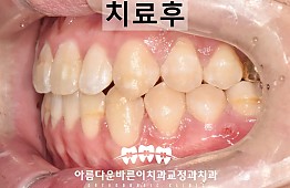 수술후