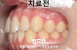 수술전