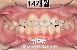 수술후