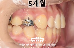 수술후