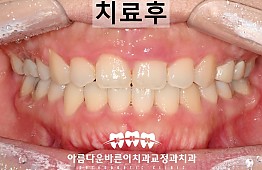 수술후