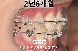 수술후