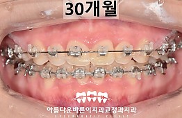 수술후