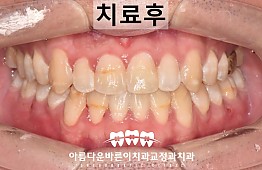 수술후