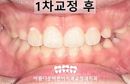 수술후