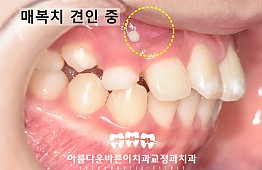 수술후