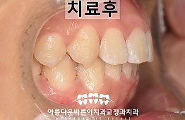 수술후