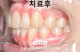 수술후