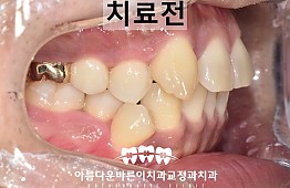 수술전