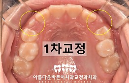 수술후