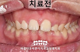 수술전