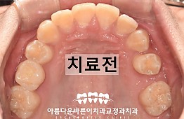 수술전