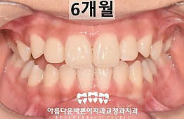 수술후