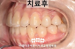 수술후