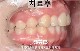 수술후