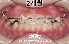 수술후