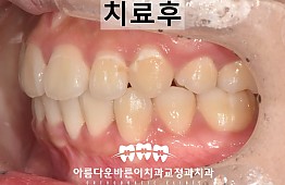 수술후