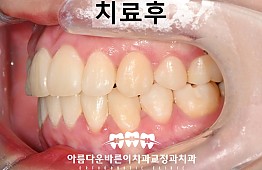 수술후