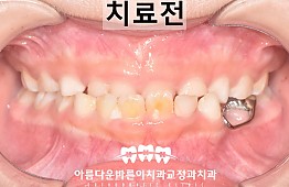 수술전