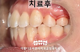 수술후