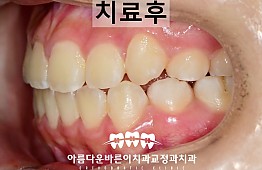 수술후