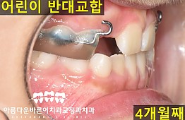 수술후