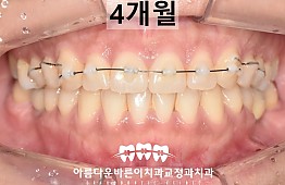 수술후