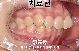 수술전