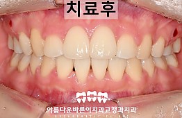 수술후