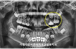 수술전