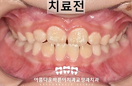 수술전