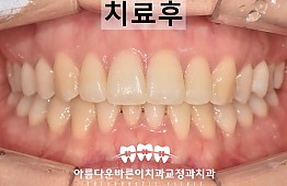 수술후