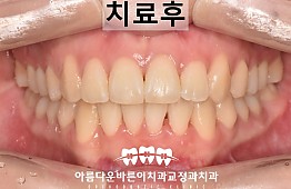 수술후