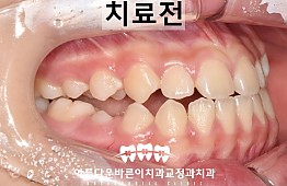 수술전