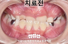 수술전