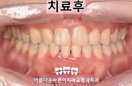 수술후