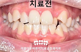 수술전