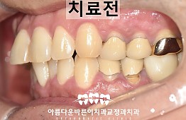 수술전