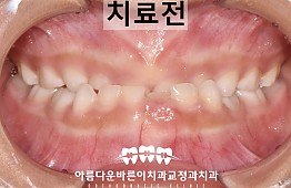 수술전