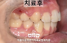 수술후