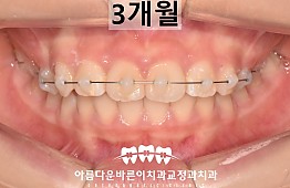 수술후