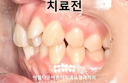 수술전