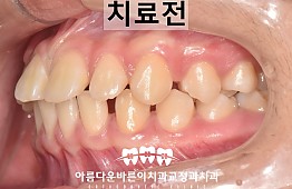 수술전