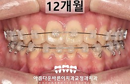 수술후