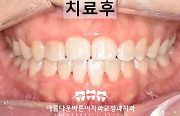 수술후