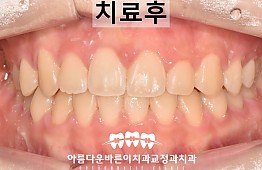 수술후