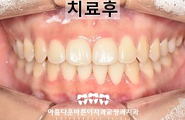 수술후