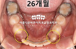 수술후