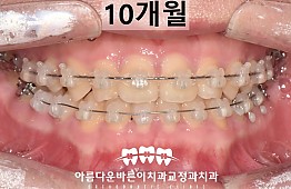 수술후