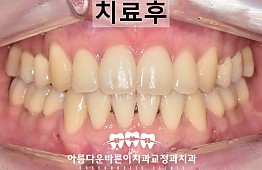 수술후